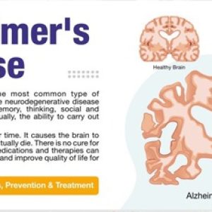 Brain would age faster and we could get Alzheimers disease, Parkinsons disease etc due to these nutrient deficiencies!!
