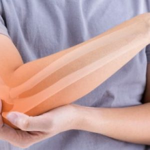 Unbelievable!! Fractures can be fixed in just 3 minutes with the help of this latest Bone Glue!!