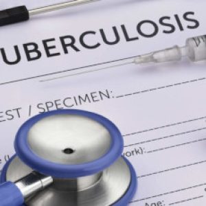 Important Foods to eat for tuberculosis or TB – Lack of vitamin that would make a person more prone to TB!!