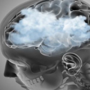 Brain Fog – Its causes, treatments, foods to eat etc!!