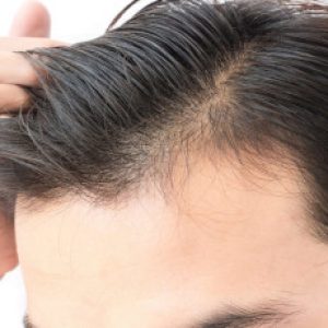 Please be careful about these hair oils as they could harm you!!