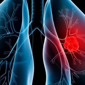 These signs would reveal the presence of lung diseases in us, take care!!