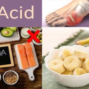Dont eat these foods if your uric acid level is high!!